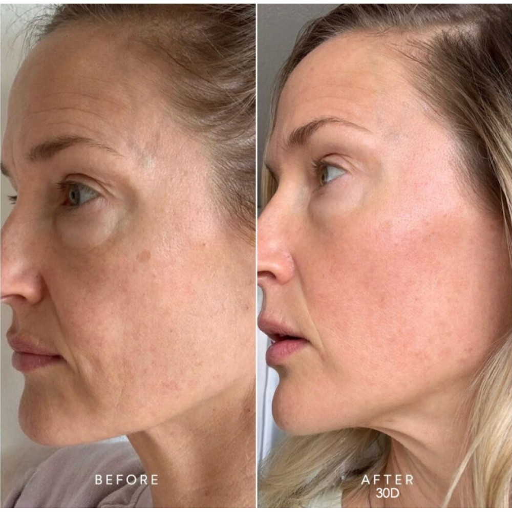 LIFTING SERUM ΧΑΒΙΑΡΙ ΜΕ ΥΑΛΟΥΡOΝΙΚΟ & MAJESTEM – 30ML Σέρουμ Προσώπου